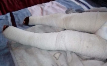 Juffrou van poging tot moord aangekla na seun (2) se brandwonde (Foto: EWN)