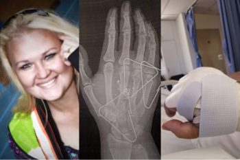 Vrou oorleef hoewe-aanval oor sy voorgee om dood te wees (Foto's: Corlene van Wyk, Facebook)