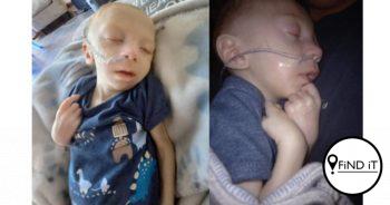 MJ is blind, kan nie self sluk nie en kry buisvoeding
