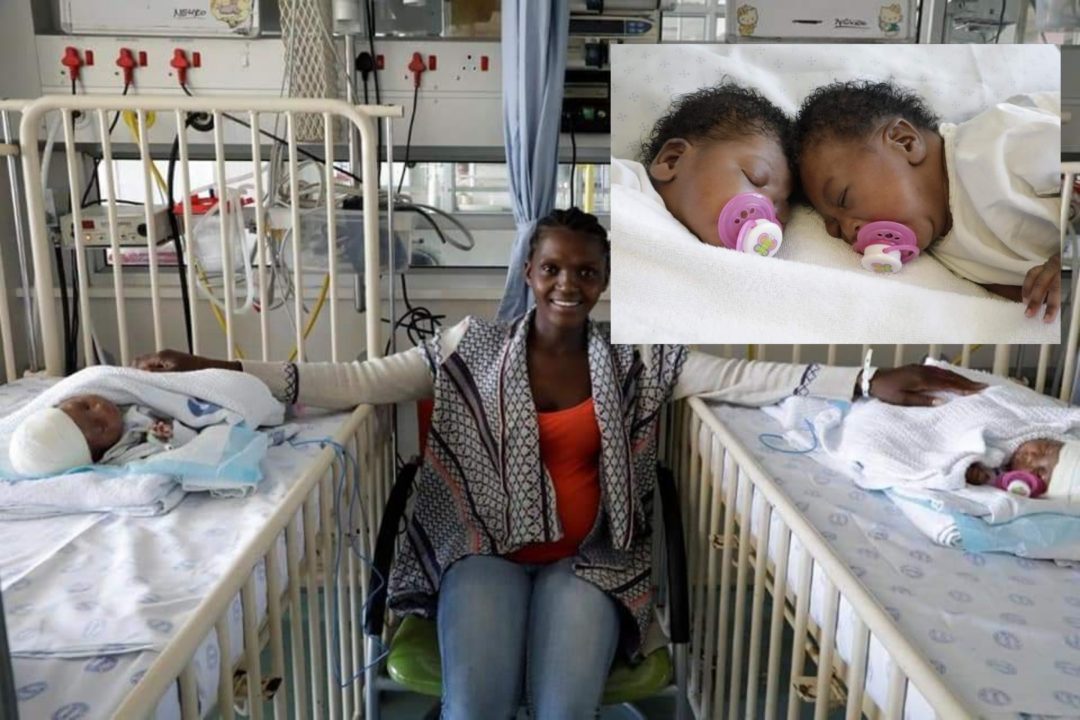 Saamgegroeide tweeling suksesvol van mekaar geskei (Foto: Western Cape Government Health)