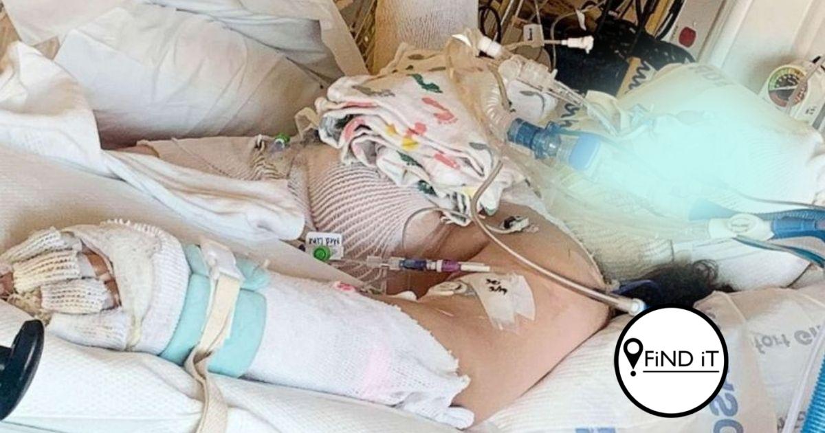 Meisie (13) ernstig beseer tydens TikTok-neiging