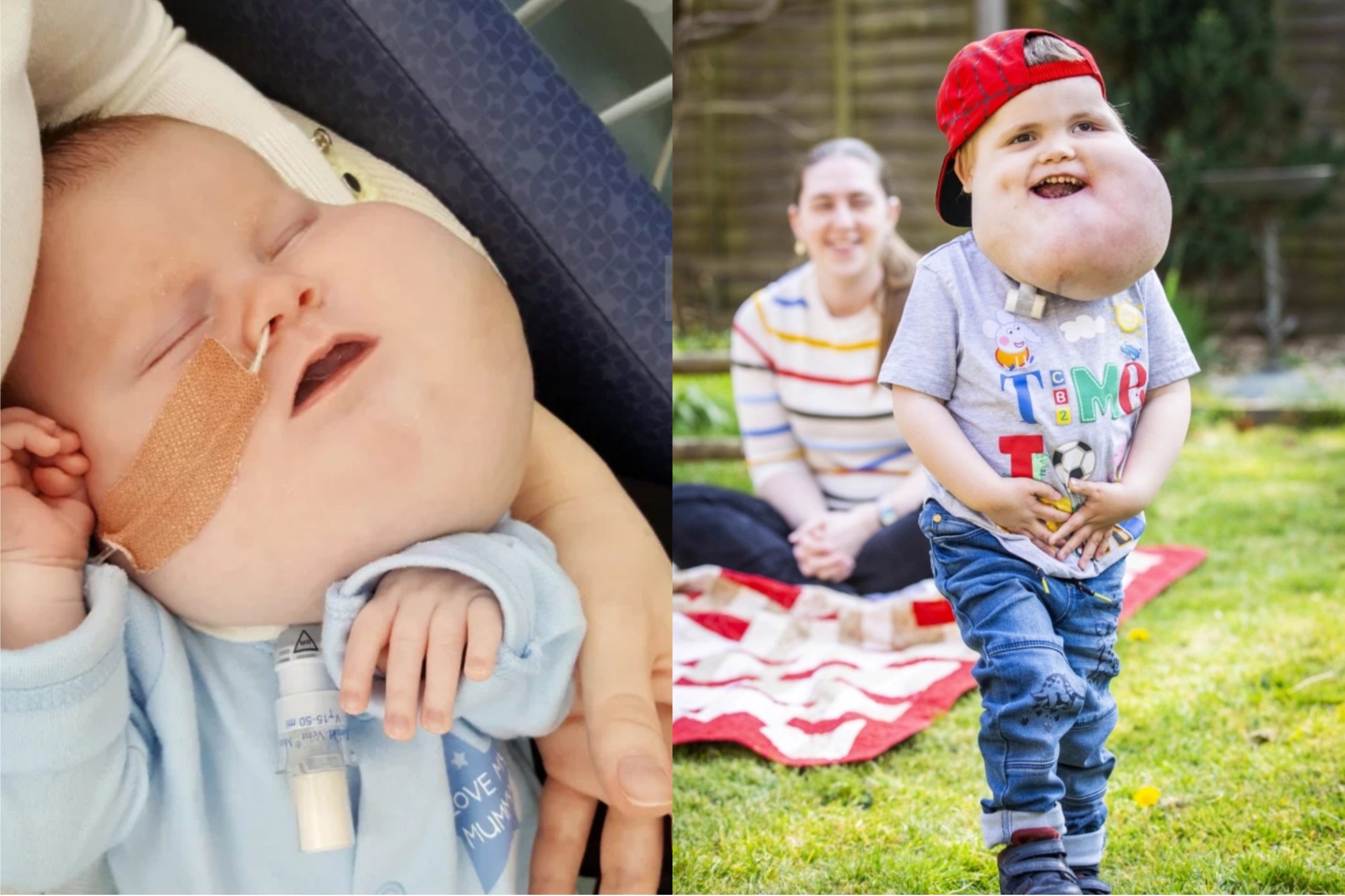 Seun (4) gee eerste treë na agt operasies om sist te verwyder (Foto's: The Sun)