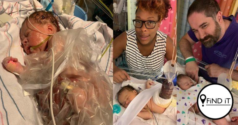 The Inside-out baby needed a life-saving quadruple organ transplant.