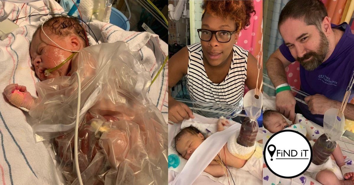 The Inside-out baby needed a life-saving quadruple organ transplant.