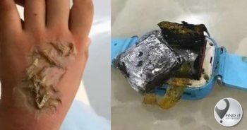 Her father said that he has contacted the unnamed manufacturer of the smartwatch that exploded about compensation and is currently in discussion with them.