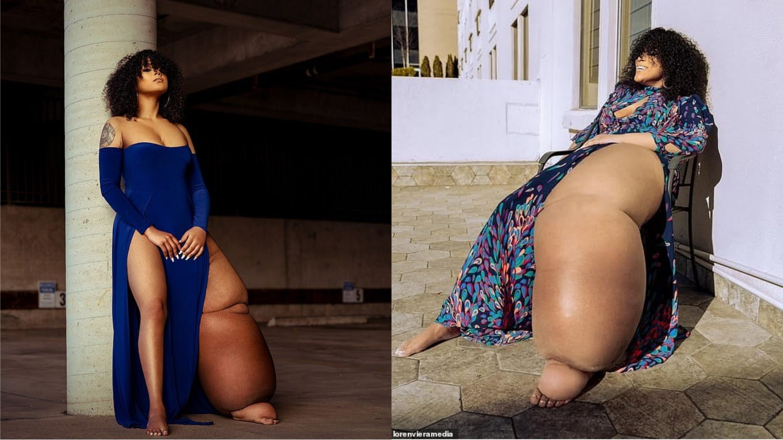 Vrou voel 'beeldskoon' ten spyte van 45 kg-been (Foto's: Daily Mail)