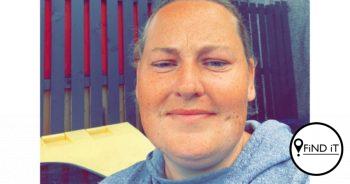 A mum-of-two who is allergic to sunlight claims she 'feels like a vampire' as exposure to it leaves her covered in painful and itchy hives