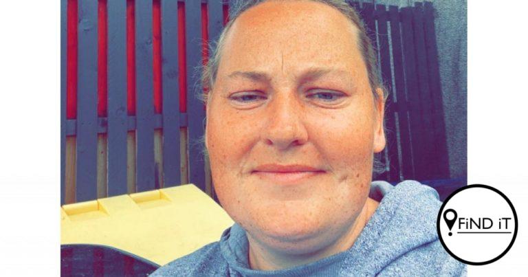 A mum-of-two who is allergic to sunlight claims she 'feels like a vampire' as exposure to it leaves her covered in painful and itchy hives