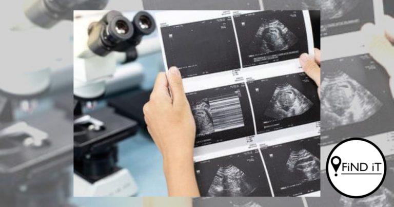 Paartjie moes baba op 25 weke laat aborteer