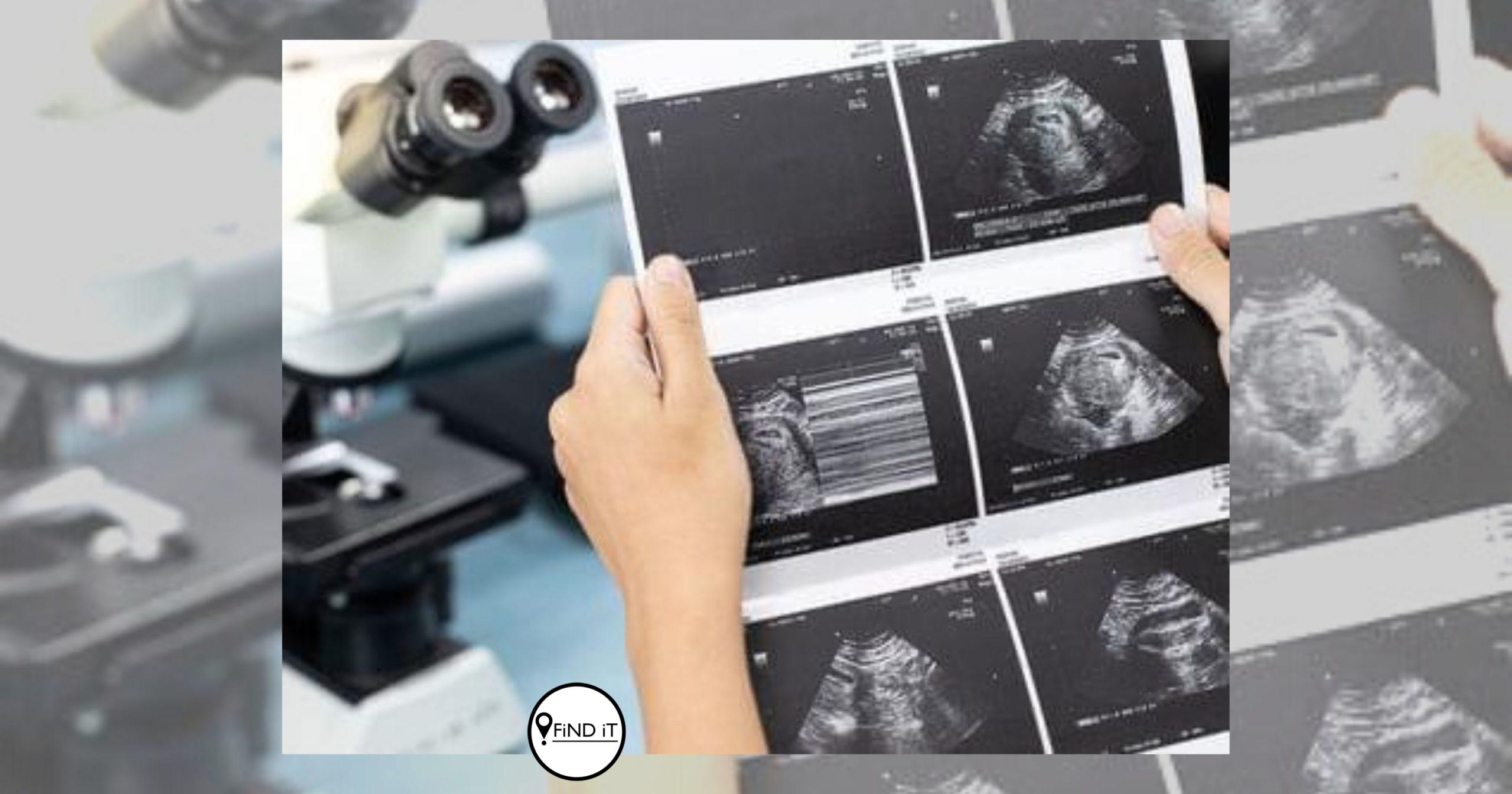 Paartjie moes baba op 25 weke laat aborteer