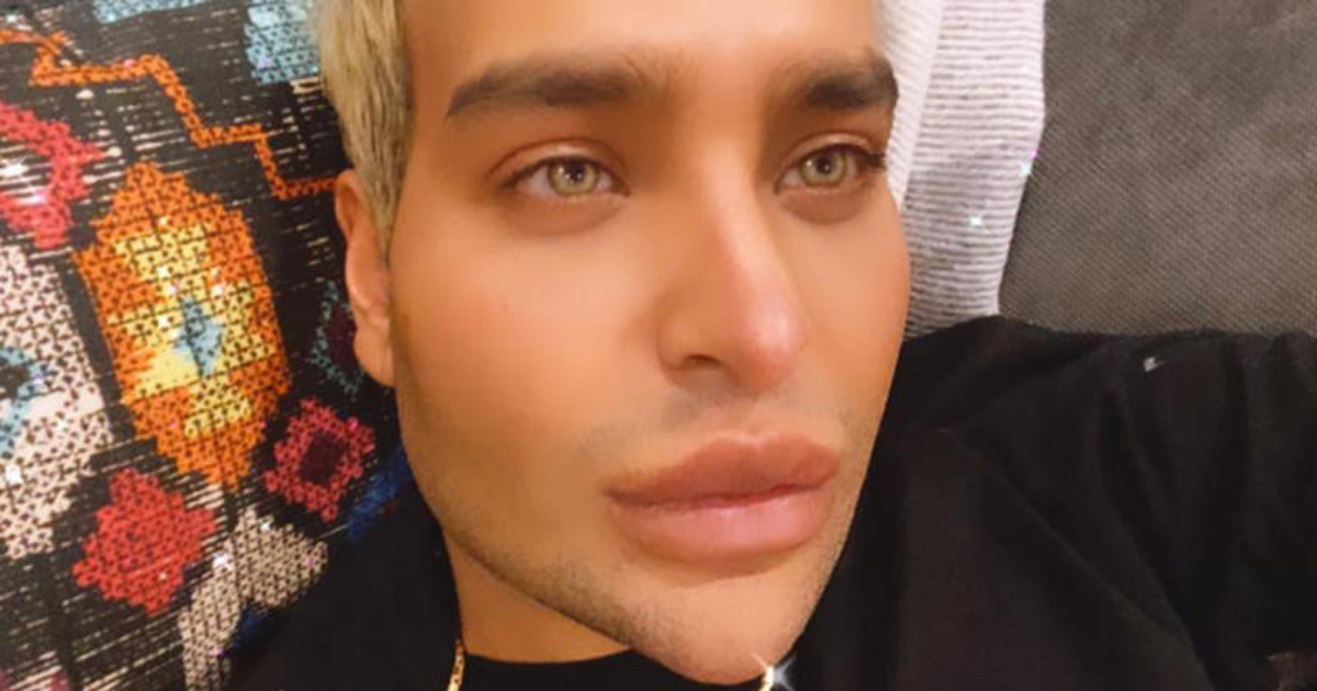 Social media addict spends 130K to look like a filter