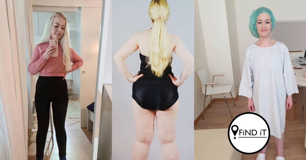 Other adults would refer to Yasmina’s legs as ‘elephant legs’ or tell her to ‘lose weight’ because she was ‘too big.’
