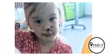 Paartjie se paaie skei na kêrel se Staffie kind (2) in gesig byt
