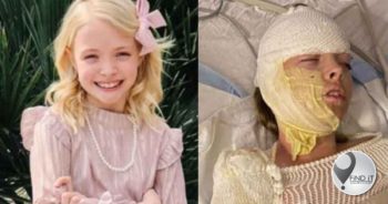 Meisie (10) brand toe gasbottel by partytjie vlam vat