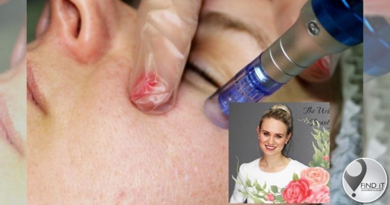Microneedling - dalk die oplossing vir jou velprobleme?