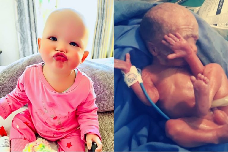 'Déjà vu-oomblik' toe tweede baba in NICU opgeneem word