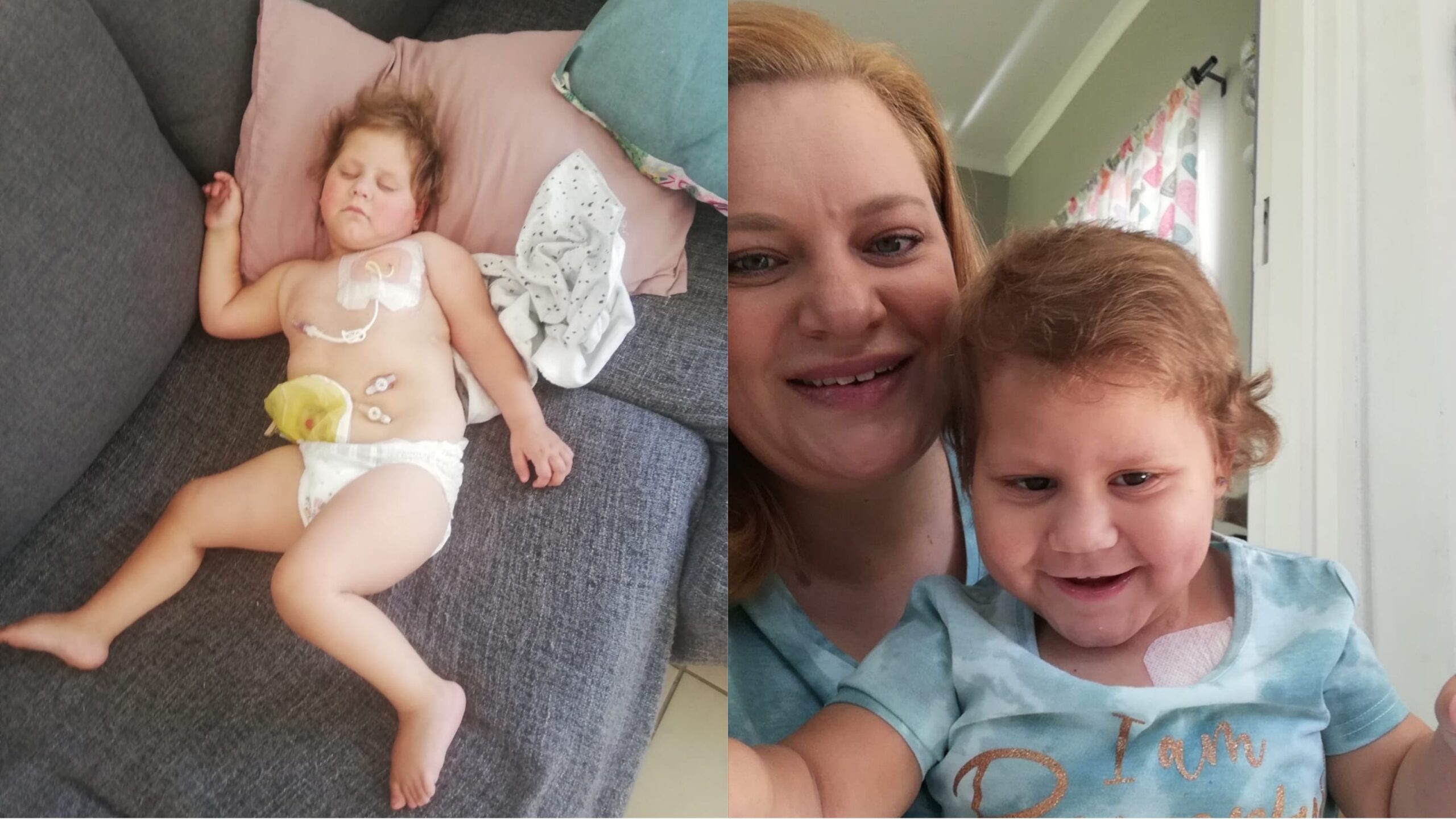 'Dokters het nie gedink Ané (3) sou 'n jaar oud word nie'
