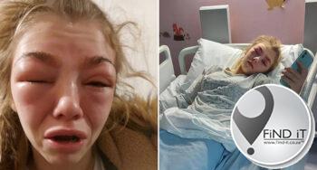 Tiener amper dood na henna op wenkbroue