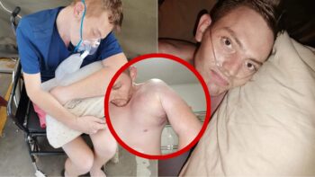 'Hy probeer, maar dis moeilik' - Kyle se vordering na diagnose