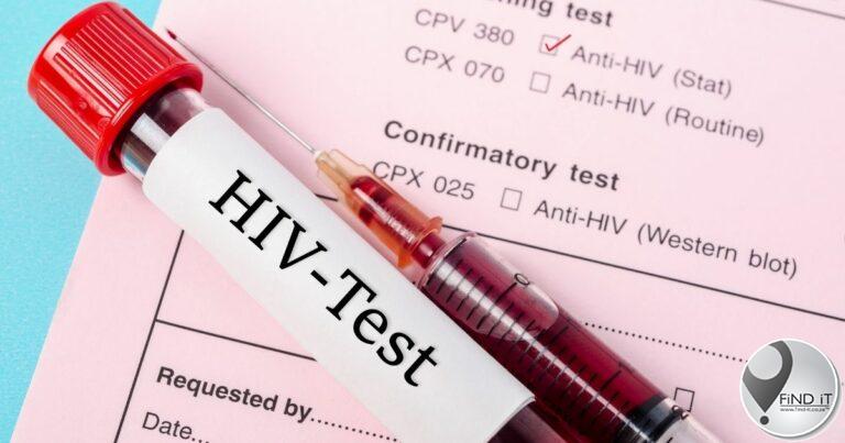 Researchers discover new HIV variant in the Netherlands
