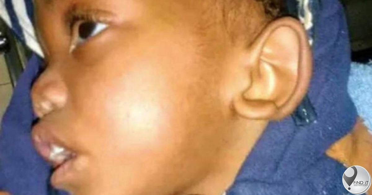 Kleuter onverwags dood ná gesig glo gebyt is laat familie in skok