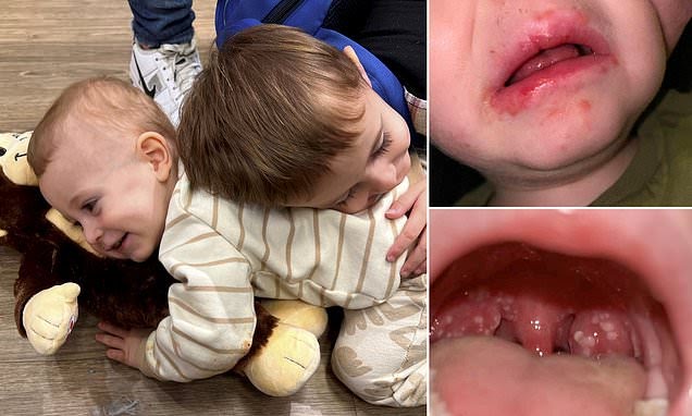 (Fotokrediet: Daily Mail)
