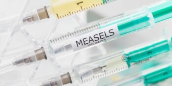 Onderwysers moet uitkyk vir masels in skole