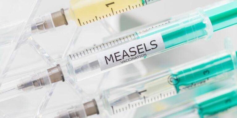 Onderwysers moet uitkyk vir masels in skole