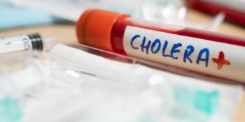 Derde cholera geval rapporteer in Johannesburg