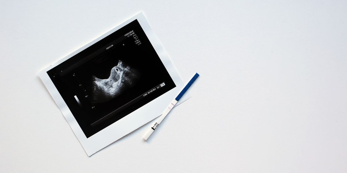 Woede ontstook oor voorstel van professor dat breindood vrouens as surrogate gebruik word