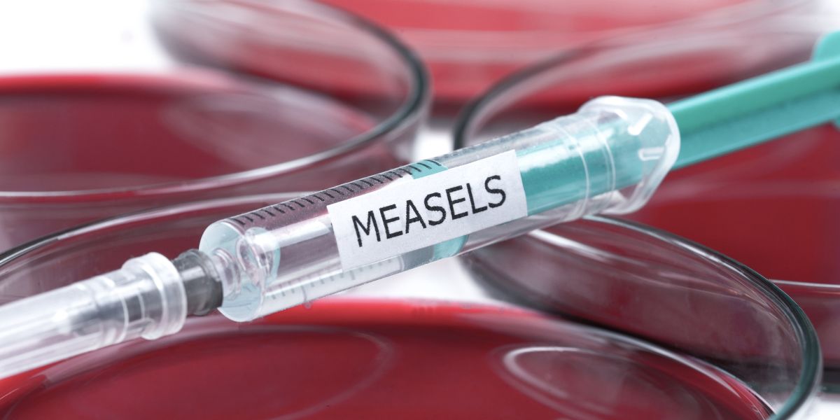 Meer as 960 maselsgevalle in Suid-Afrika aangemeld
