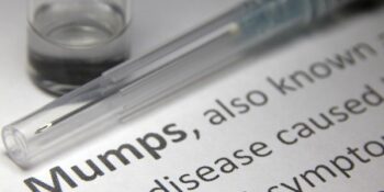 Confirmation of mumps outbreak in South Africa