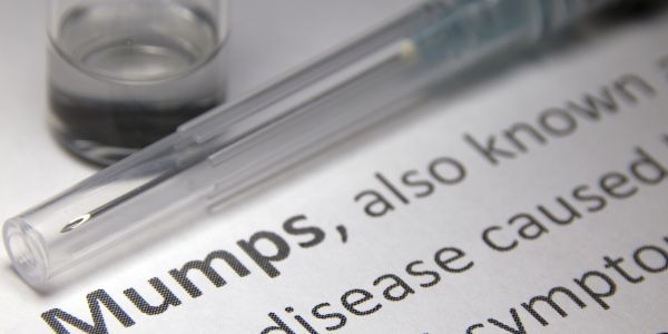 Confirmation of mumps outbreak in South Africa